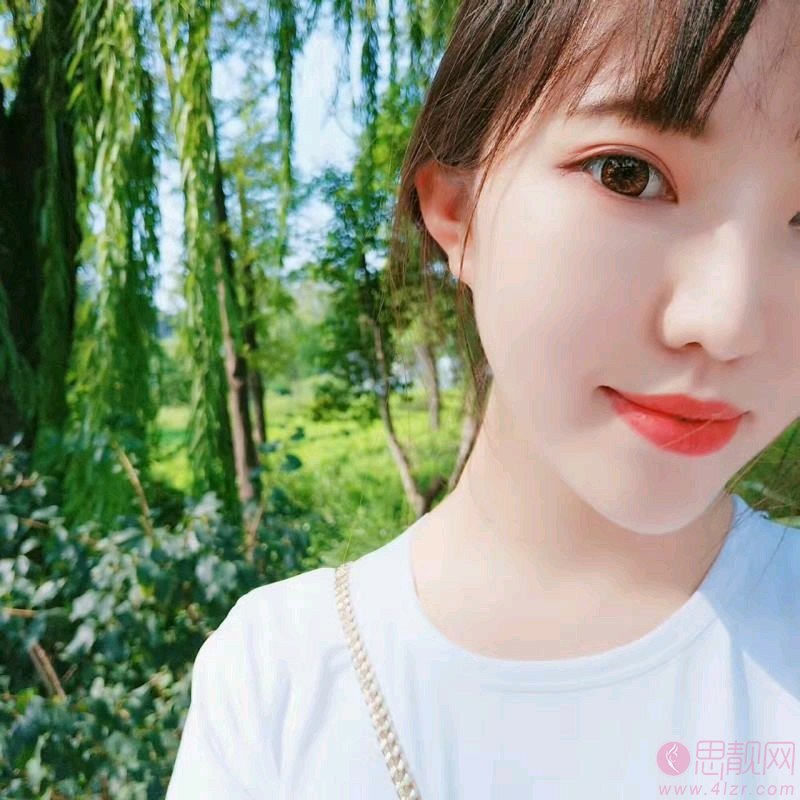 厦门欧韵医疗美容做双眼皮怎么样？2020价格表曝光+双眼皮真人分享