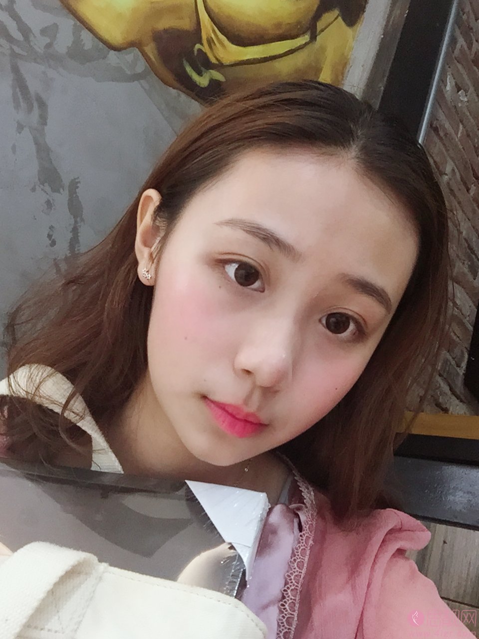 上海盈美医疗美容杨璐做下眼下至术怎么样？2020价格表曝光