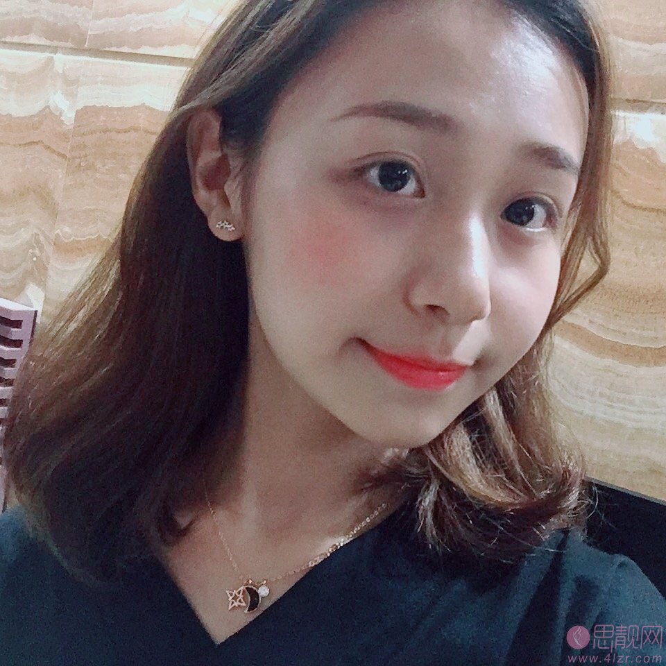 上海盈美医疗美容杨璐做下眼下至术怎么样？2020价格表曝光
