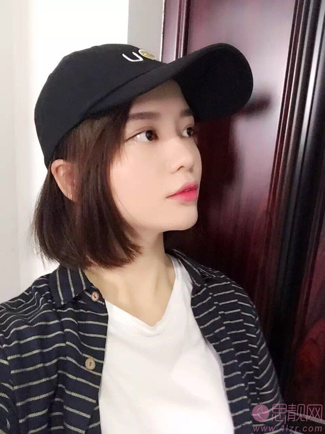 星和医美(上海长宁店) 玻尿酸丰下巴怎么样?附真人案例分享及2020价格表一览