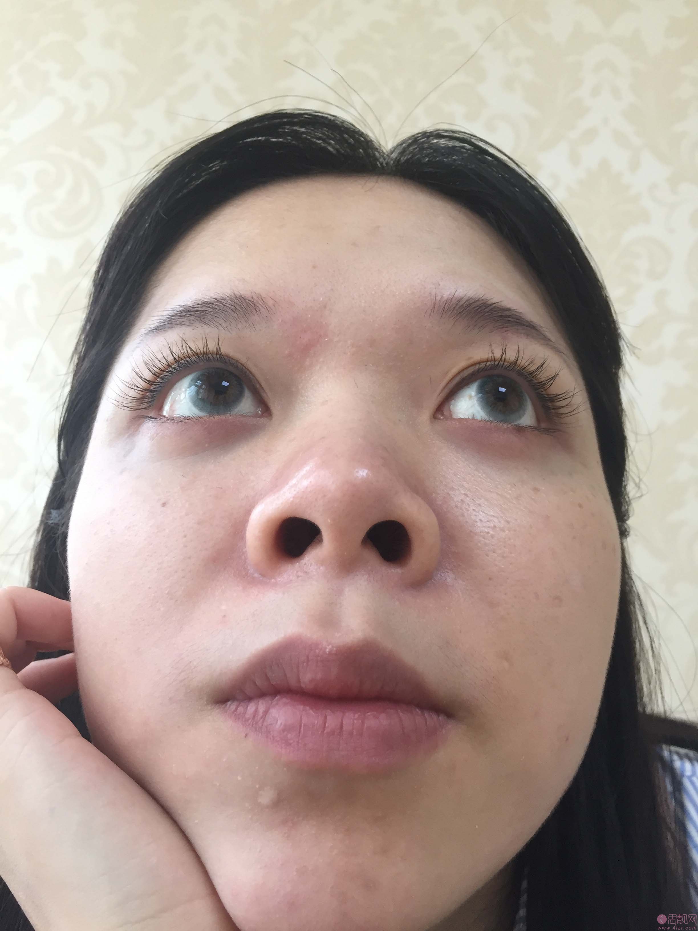 厦门福华（金贵香）医疗美容医院金贵香隆鼻如何？2020价格表一览