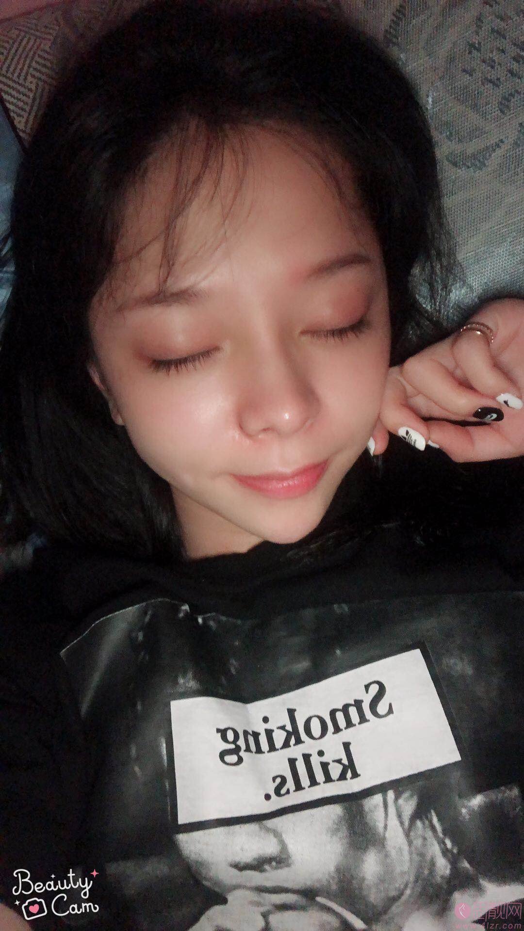 厦门福华（金贵香）医疗美容医院金贵香隆鼻如何？2020价格表一览