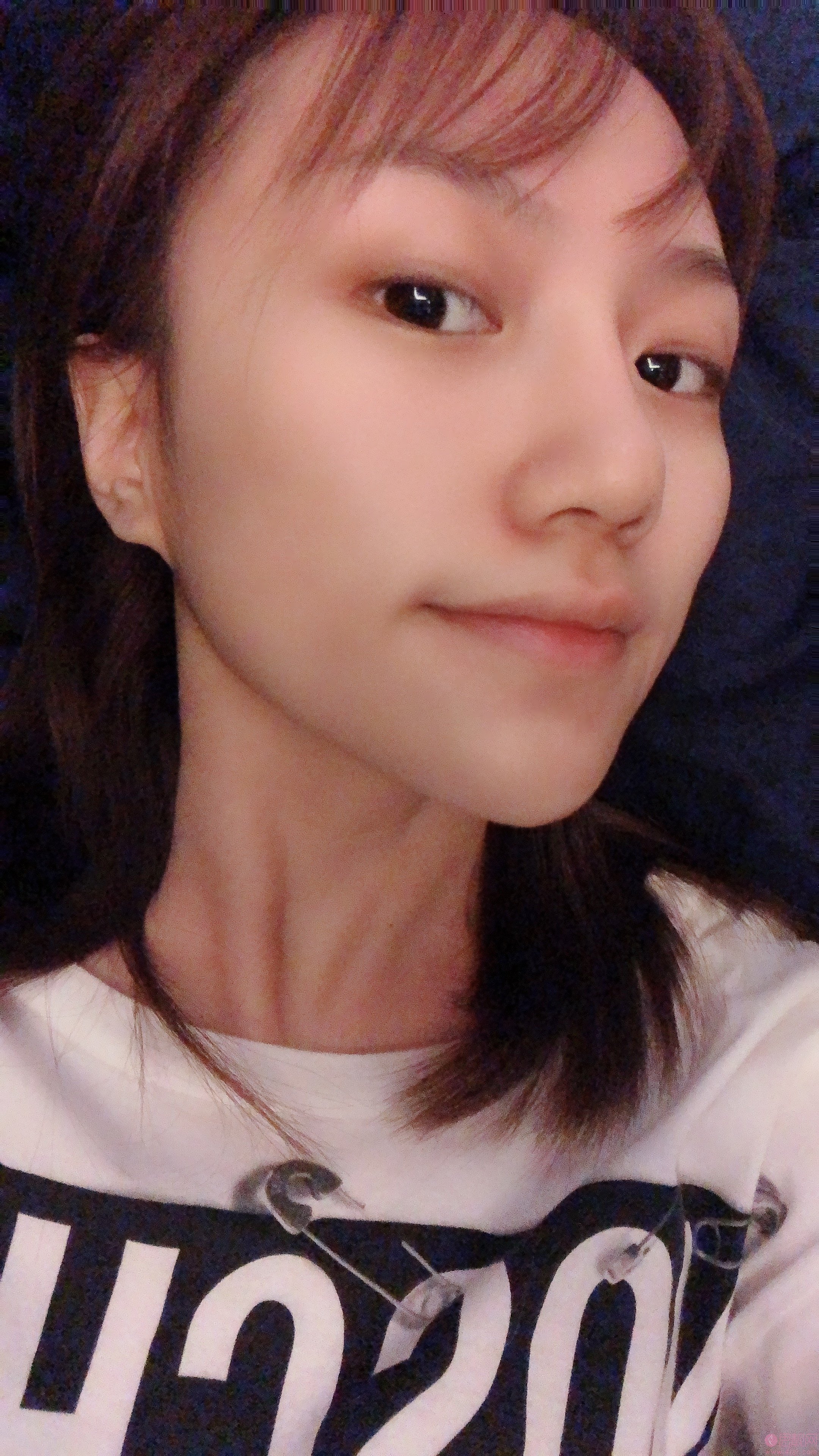 成都艺星医疗美容何林做双眼皮怎么样？附双眼皮真人前后对比案例及2020价格表出炉
