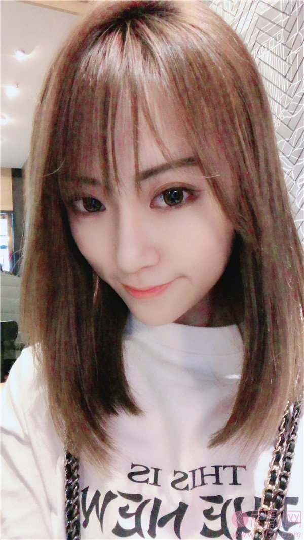 成都艺星医疗美容何林做双眼皮怎么样？附双眼皮真人前后对比案例及2020价格表出炉