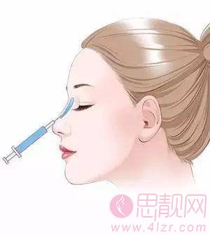玻尿注射酸好吗？玻尿酸注射隆鼻后效果怎么样？有没有什么副作用？