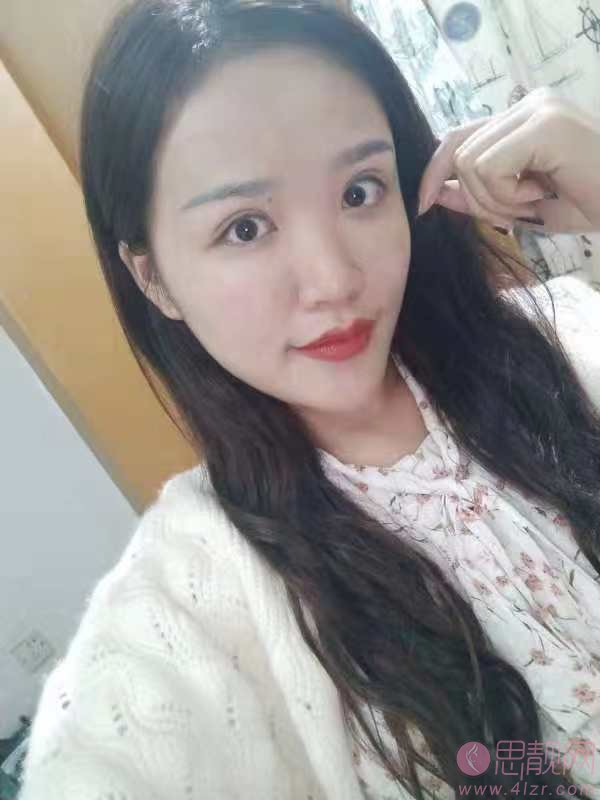 福州涵美医疗美容隆鼻好不好？2020价格表曝光+隆鼻真人案例分享
