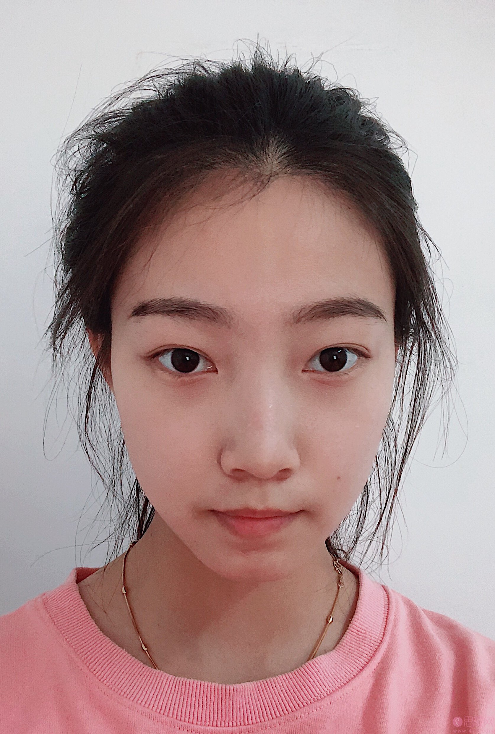 福州超美医疗美容隆鼻多少钱？2020价格表爆光