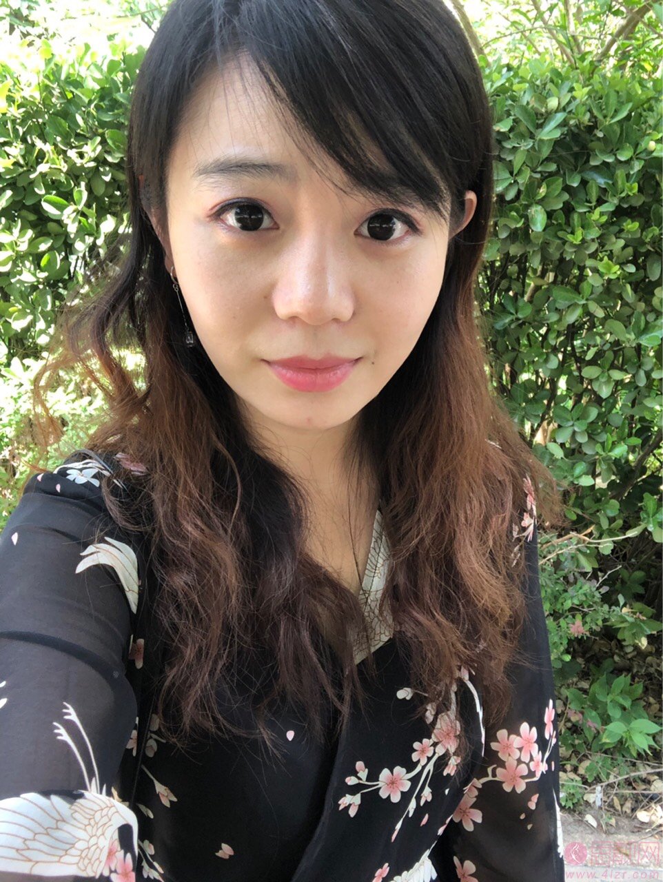福州博美整形美容祛眼袋怎么样？2020价格表上线+祛眼袋真人案例分享