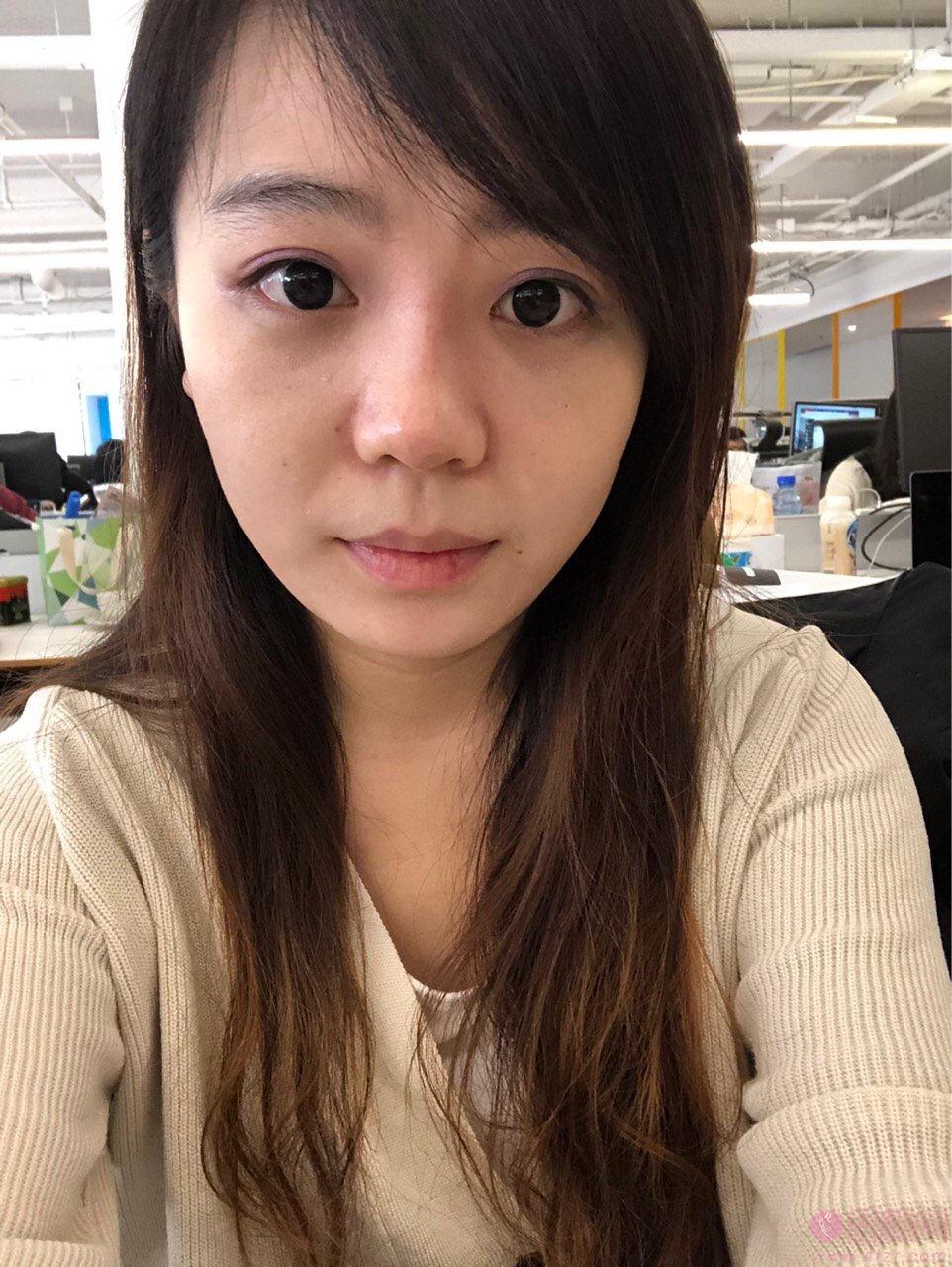 福州博美整形美容祛眼袋怎么样？2020价格表上线+祛眼袋真人案例分享