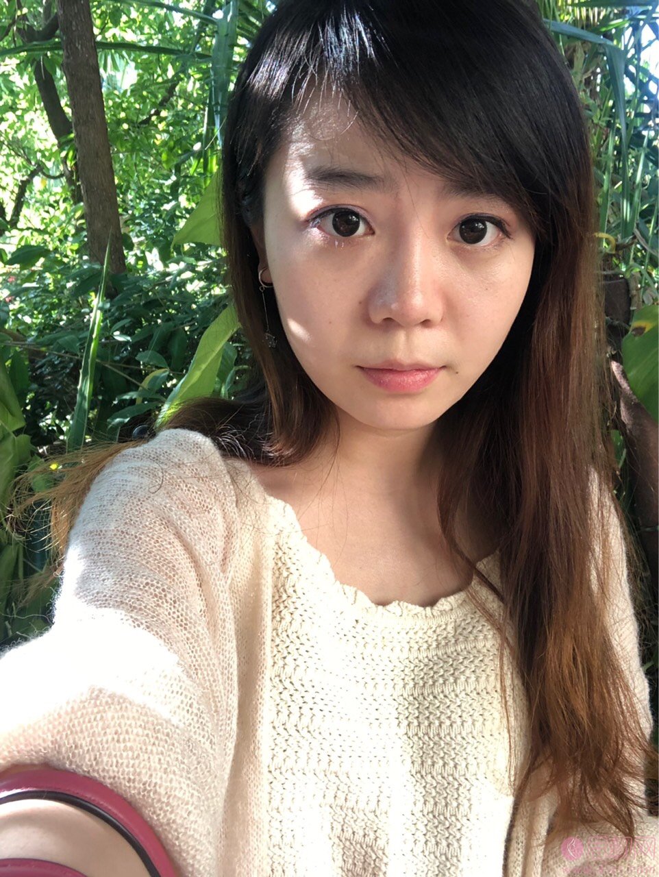 福州博美整形美容祛眼袋怎么样？2020价格表上线+祛眼袋真人案例分享