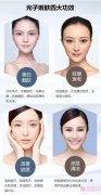 光子嫩肤的功效、治疗及注意事项