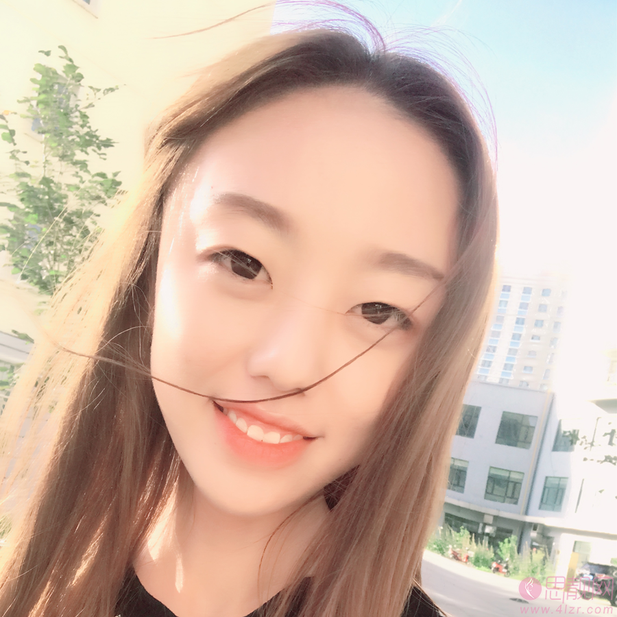 贵阳华美整形美容医院做双眼皮手术好不好？2020价格表曝光+双眼皮术后三个月效果展示