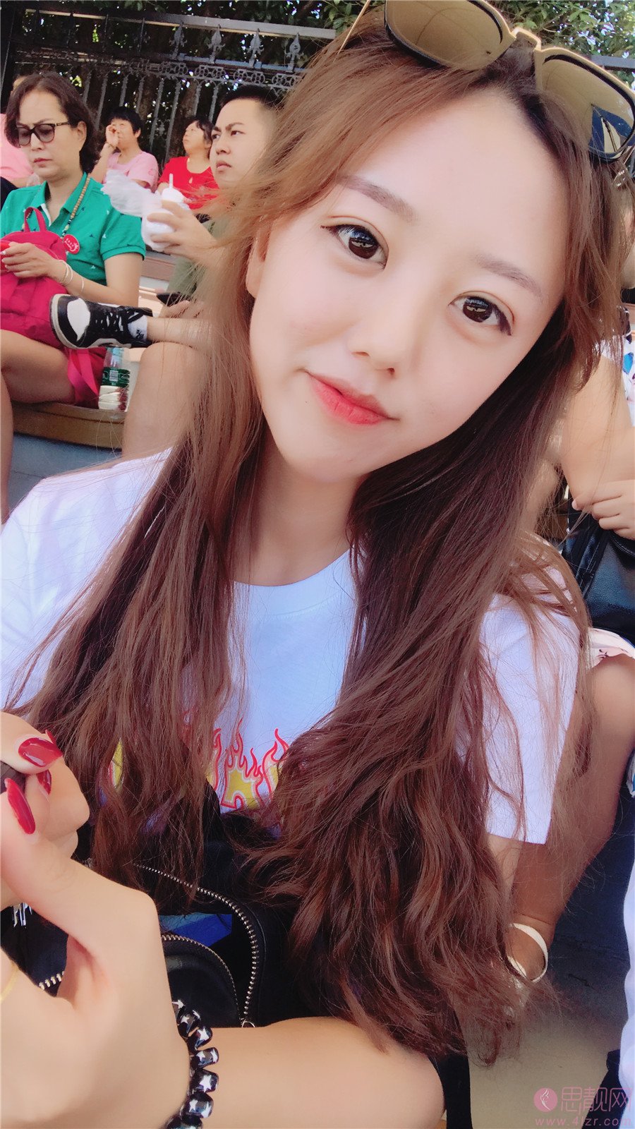 贵阳华美整形美容医院做双眼皮手术好不好？2020价格表曝光+双眼皮术后三个月效果展示