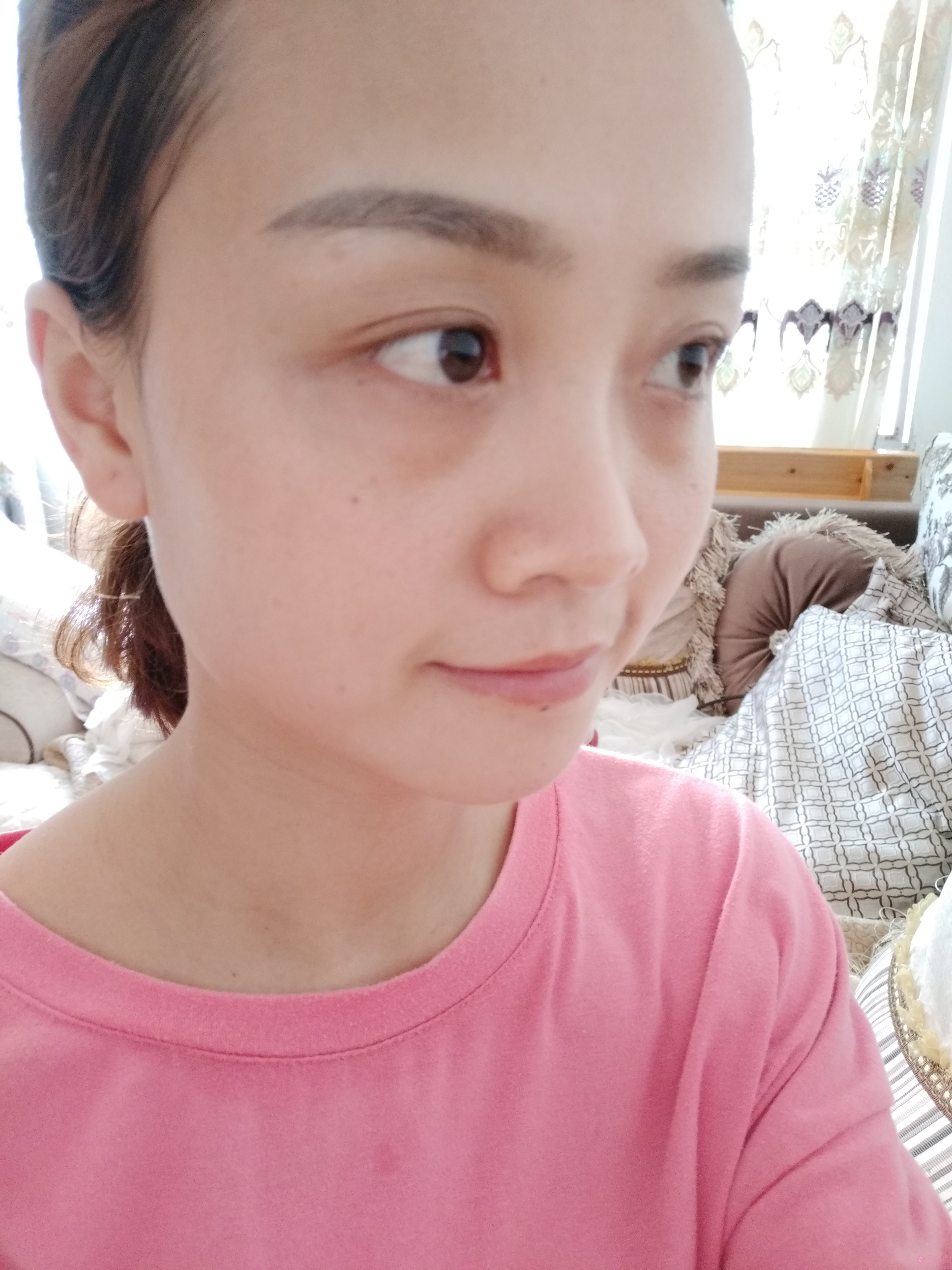 贵阳丽都医疗美容医院口碑好不好?附内切祛眼袋真人案例分享及2020价格表上线