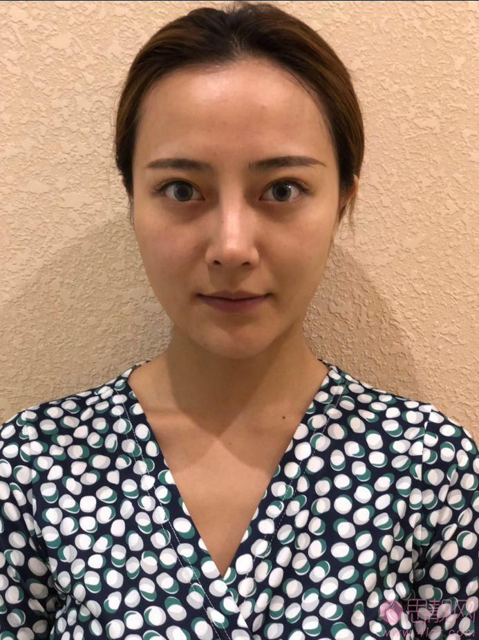 成都精美源医疗美容做埋线提升怎么样？2020价格表全新曝光