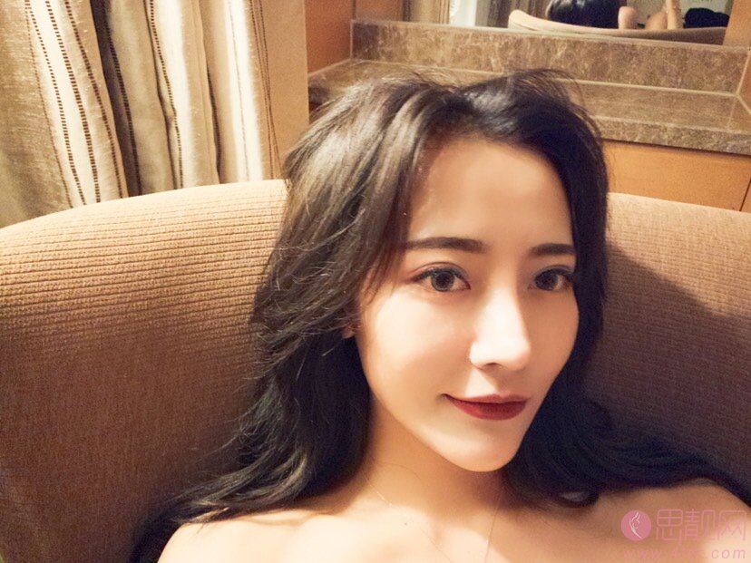 成都精美源医疗美容做埋线提升怎么样？2020价格表全新曝光