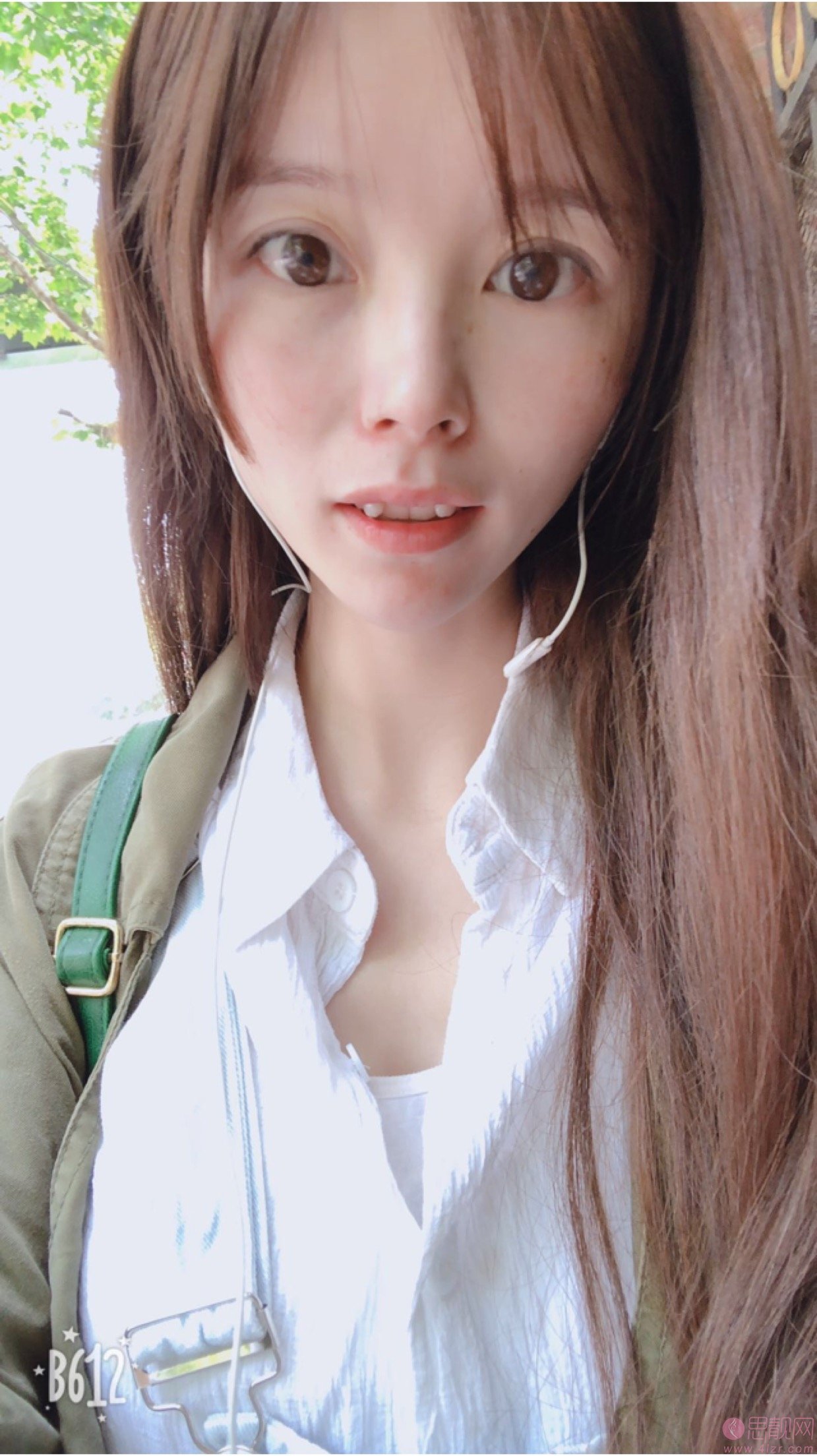 上海玫瑰美容医院齿科矫正牙齿怎么样?2020价格表曝光+牙齿矫正真人分享