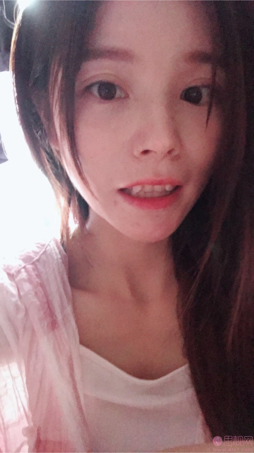 上海玫瑰美容医院齿科矫正牙齿怎么样?2020价格表曝光+牙齿矫正真人分享