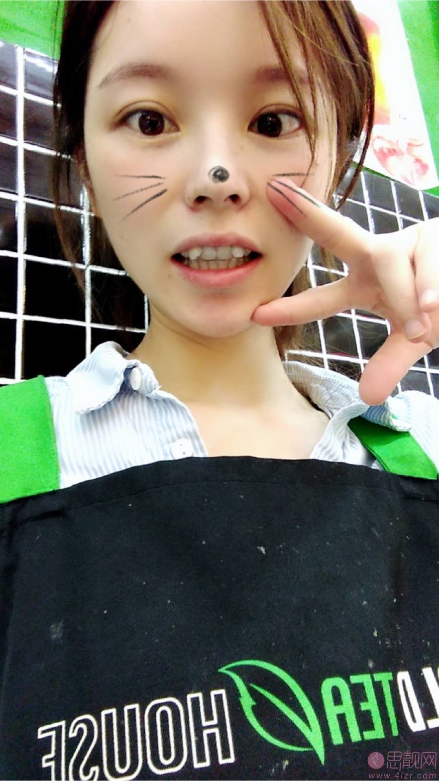 上海玫瑰美容医院齿科矫正牙齿怎么样?2020价格表曝光+牙齿矫正真人分享