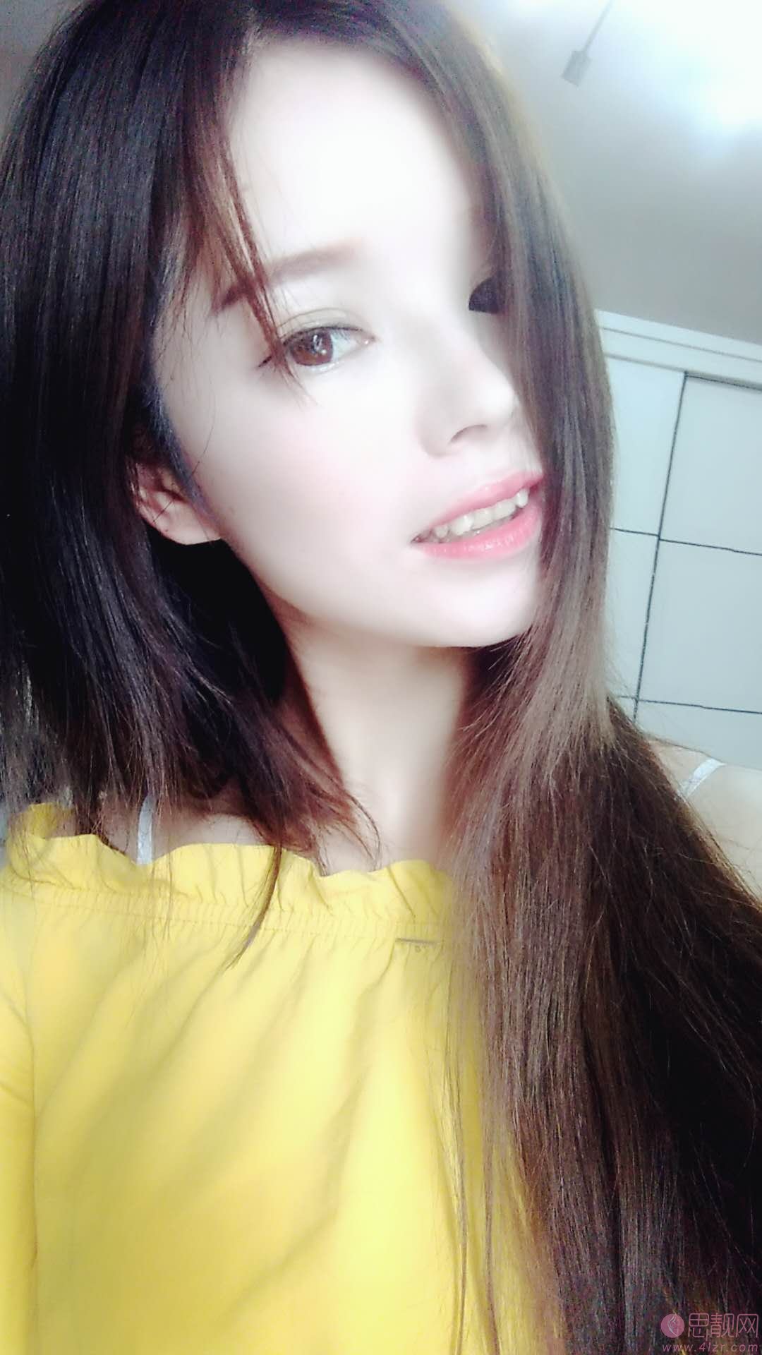 上海玫瑰美容医院齿科矫正牙齿怎么样?2020价格表曝光+牙齿矫正真人分享