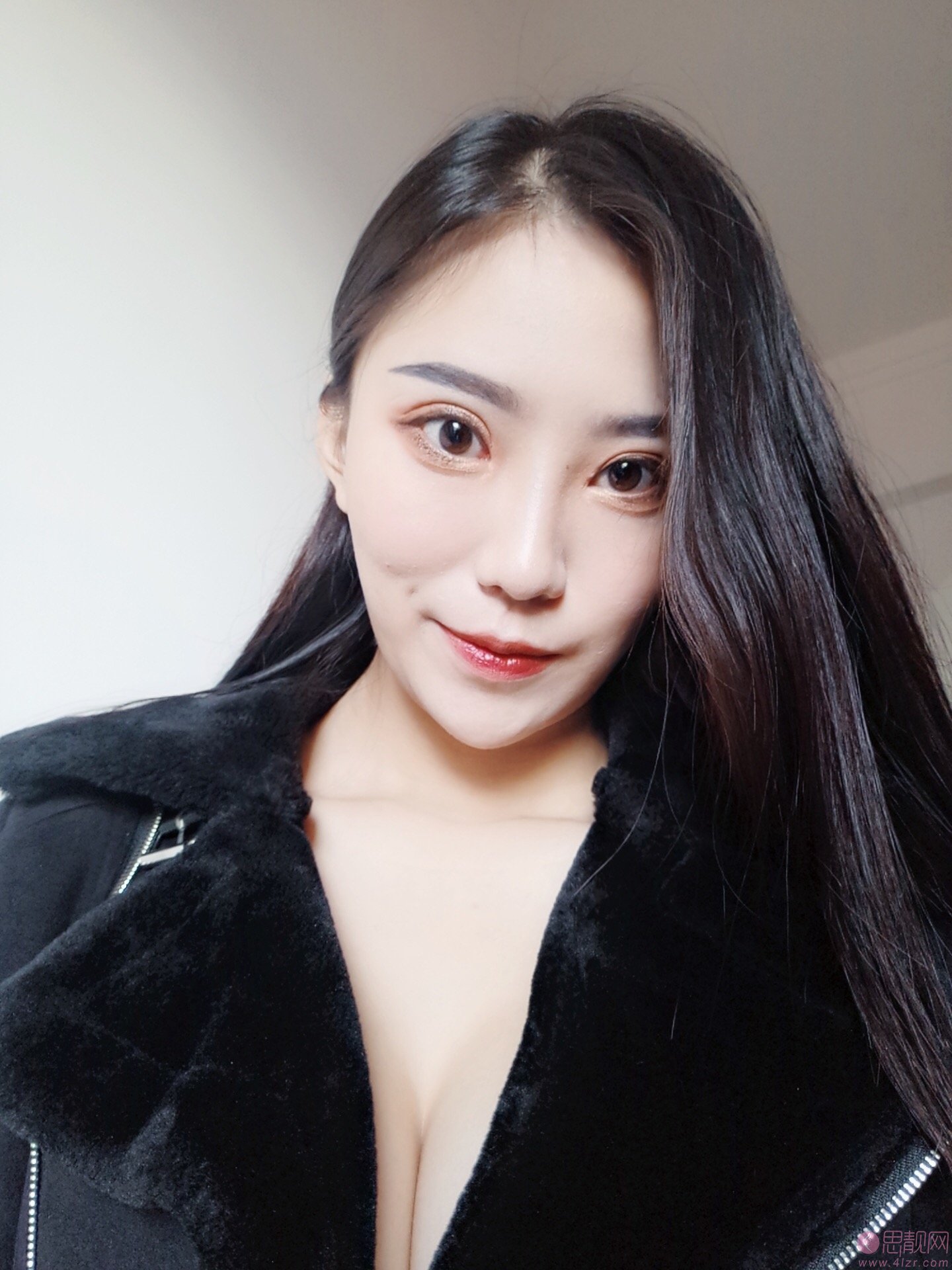 成都美上美医疗美容罗通贵医生做假体隆胸怎么样？2020价格表一览+隆胸真人案例分享