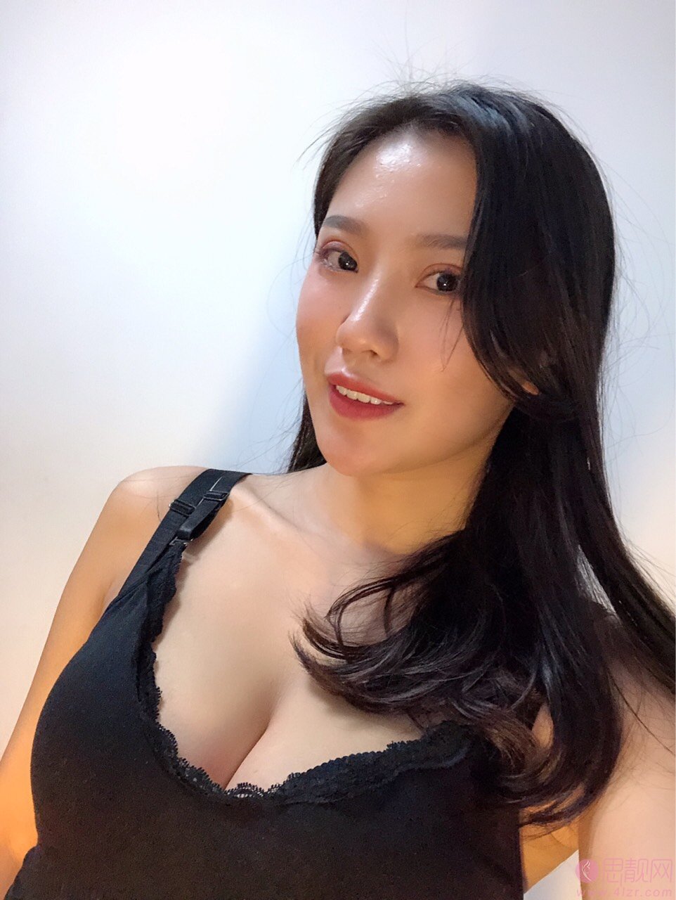 成都美上美医疗美容罗通贵医生做假体隆胸怎么样？2020价格表一览+隆胸真人案例分享