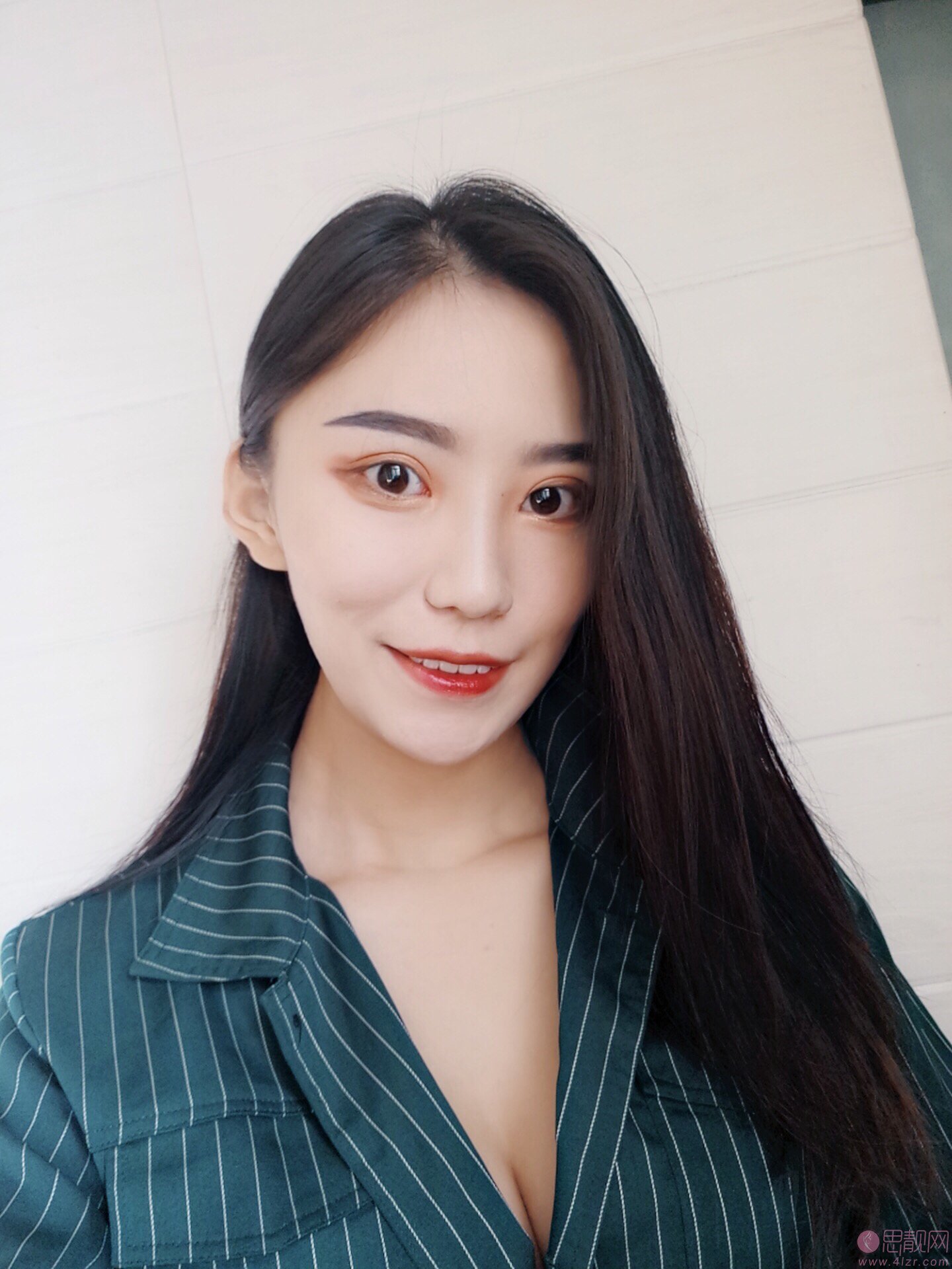 成都美上美医疗美容罗通贵医生做假体隆胸怎么样？2020价格表一览+隆胸真人案例分享