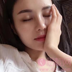成都美未央医疗美容隆鼻怎么样？2020价格表曝光+隆鼻真人案例分享