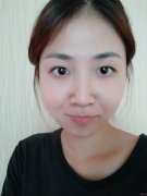 昆明市延安医院医学美容医院做下颌角切除术好不好？附下颌角案例前后对比效