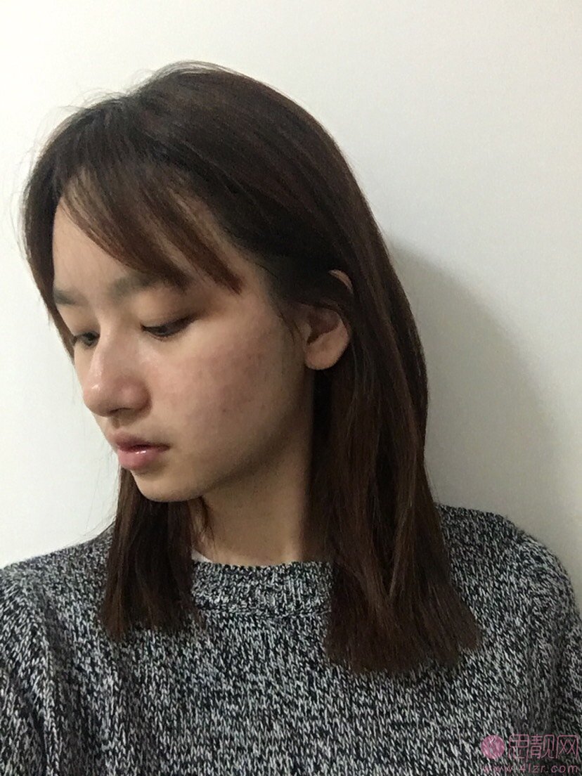 成都天府新区俪颜医疗美容诊所有限责任公司罗小强医生做假体垫眉弓怎么样？2020价格表曝光