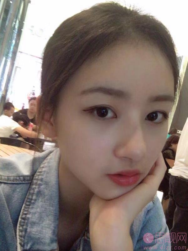 成都天府新区俪颜医疗美容诊所有限责任公司罗小强医生做假体垫眉弓怎么样？2020价格表曝光