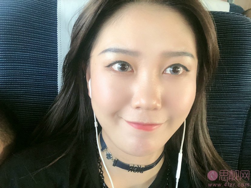 成都天使之翼医学美容医院做双眼皮怎么样？2020价格表一览+双眼皮真人案例分享