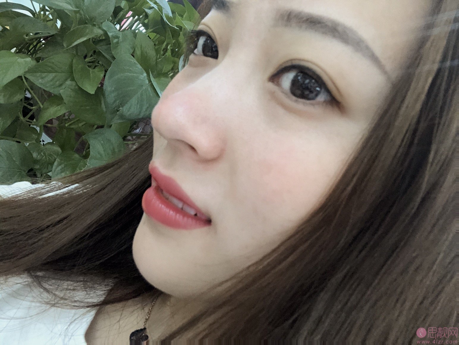 成都铜雀台医学美容医院江涛医生做隆鼻怎么样？2020价格表曝光