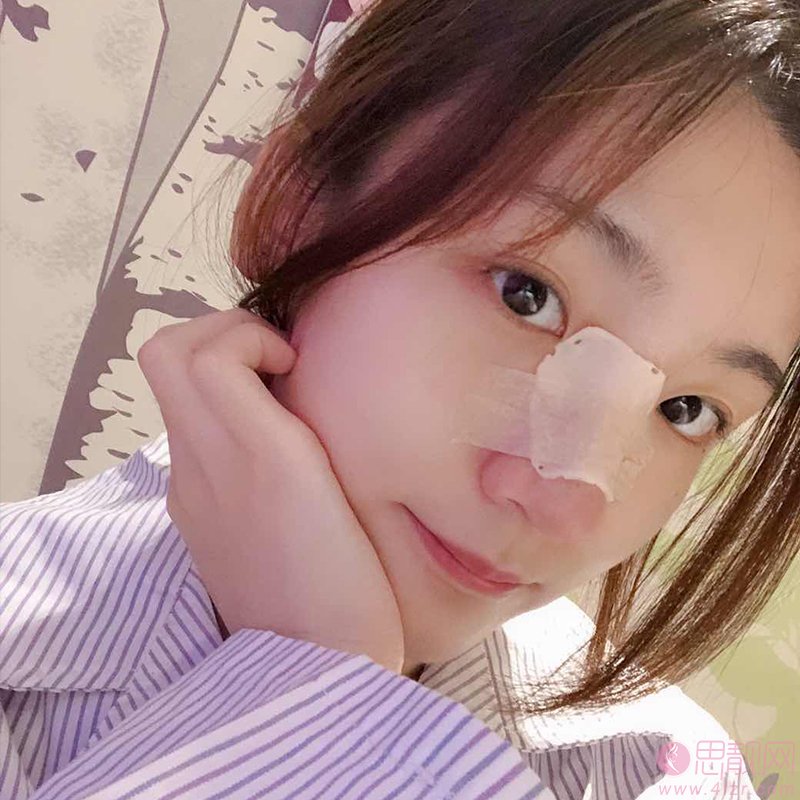成都华颜医学美容医院隆鼻怎么样？2020价格表曝光隆鼻真人分享