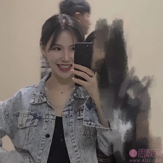东莞壹加壹整形美容医院矫正牙齿多少钱？2020价格表一览+牙齿矫正真人案例