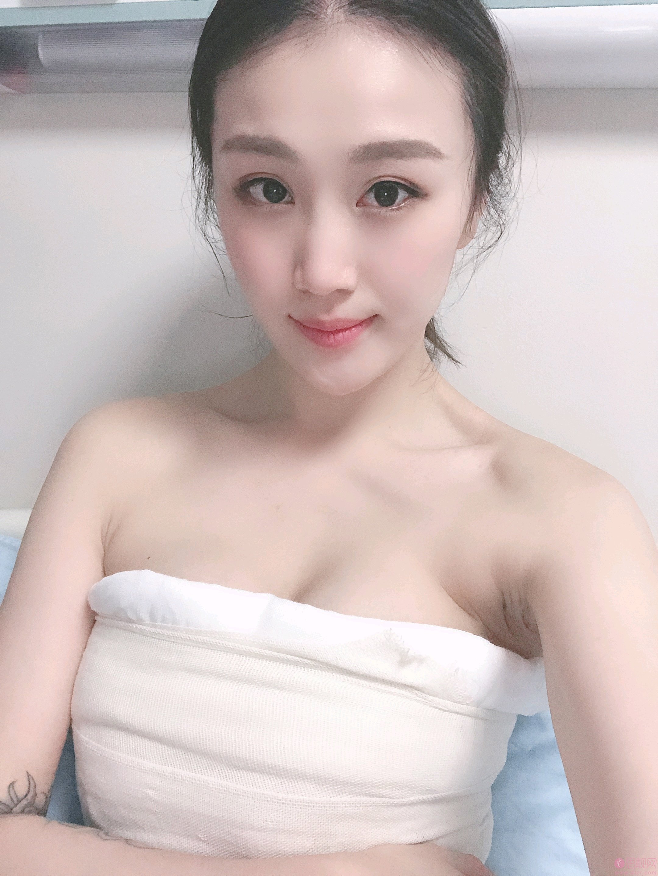郑州欧华医疗美容医院李永峰医生隆胸怎么样？2020价格表出炉+隆胸真人案例分享