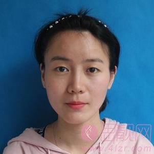 武汉伊美馨医疗美容黄蕾医生做双眼皮如何？2020价格表上线+双眼皮术后真人反馈案例