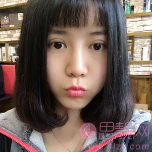 武汉伊美馨医疗美容黄蕾医生做双眼皮如何？2020价格表上线+双眼皮术后真人反馈案例