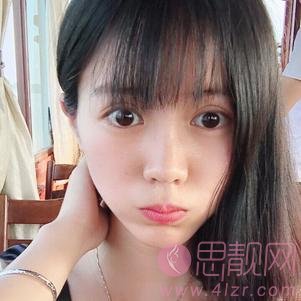 武汉伊美馨医疗美容黄蕾医生做双眼皮如何？2020价格表上线+双眼皮术后真人反馈案例
