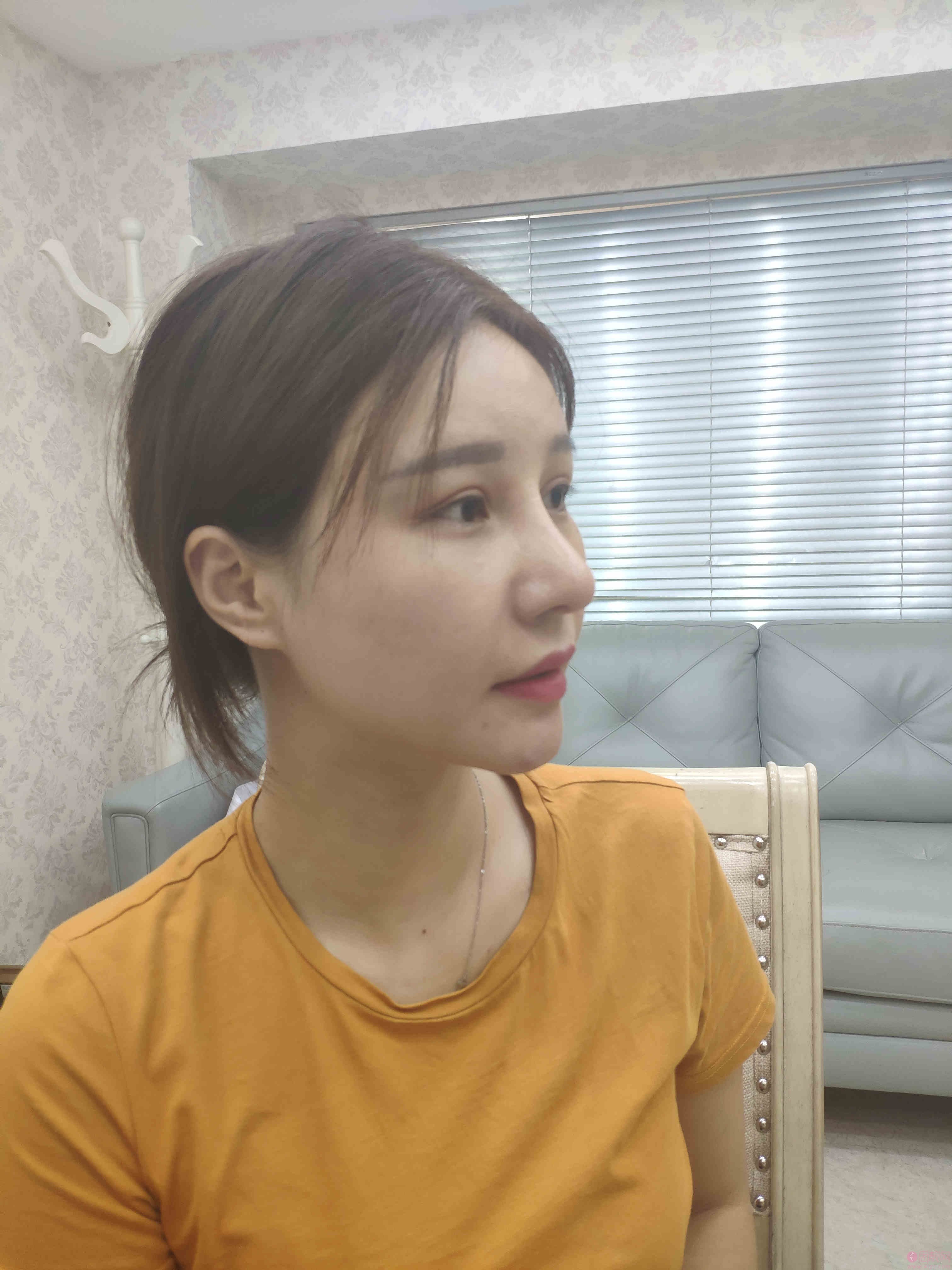 北京首玺丽格医疗美容韩胜医生做埋线提升怎么样？2020价格表曝光