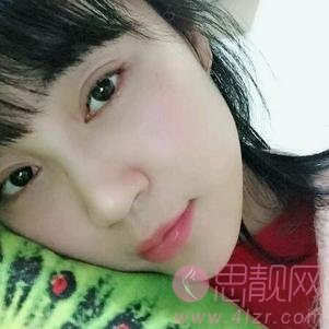 武汉美都医疗美容门诊部做双眼皮手术怎么样?2020价格表出炉+双眼皮术后真人反馈案例