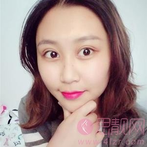 云南华美美莱美容医院做双眼皮手术好不好？附双眼皮真人案例分享及2020价格表一览