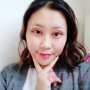 云南华美美莱美容医院做双眼皮手术好不好？附双眼皮真人案例分享及2020价格表一览