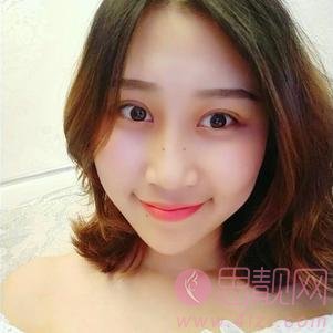 云南华美美莱美容医院做双眼皮手术好不好？附双眼皮真人案例分享及2020价格表一览