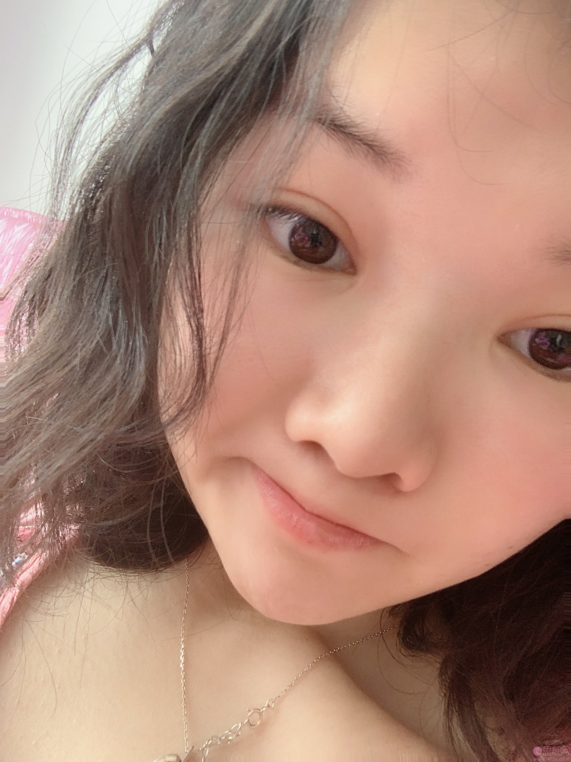 西安悦华医疗美容门诊部党稳平自体脂肪隆胸怎么样？2020价格表曝光+隆胸真人案例一览