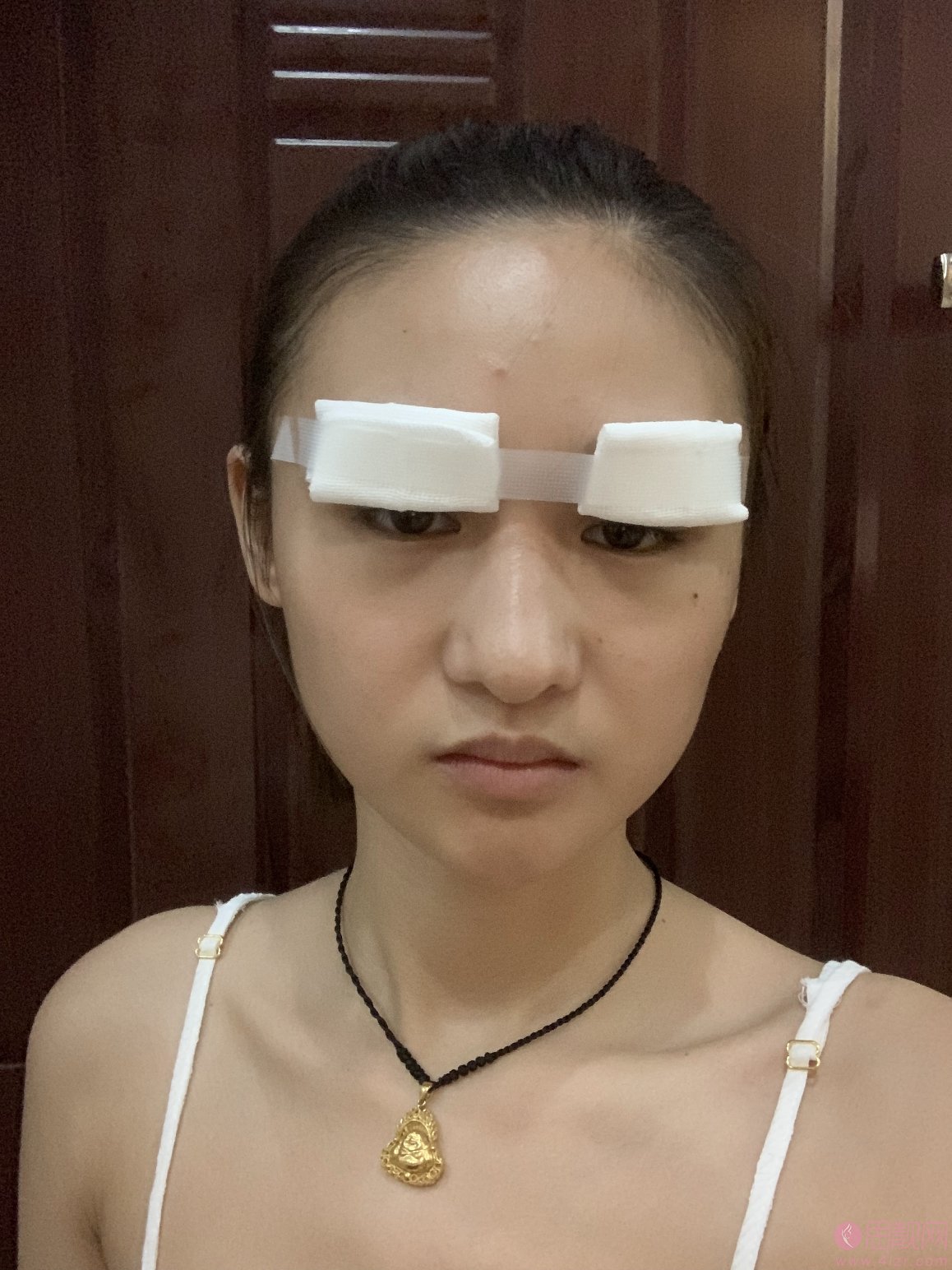 东莞韩美美容医院曾庆明医生做双眼皮怎么样？2020价格表曝光