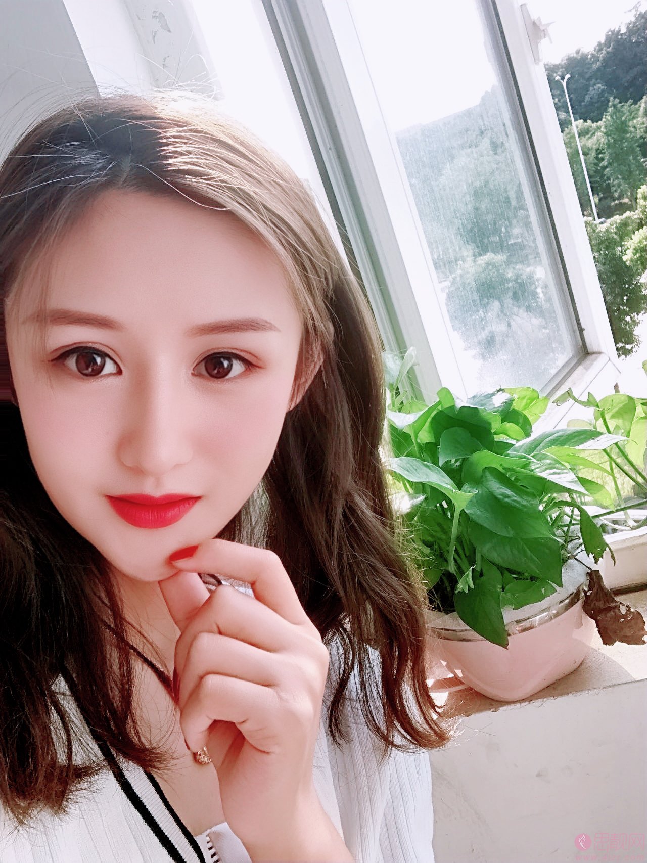 东莞韩美美容医院曾庆明医生做双眼皮怎么样？2020价格表曝光