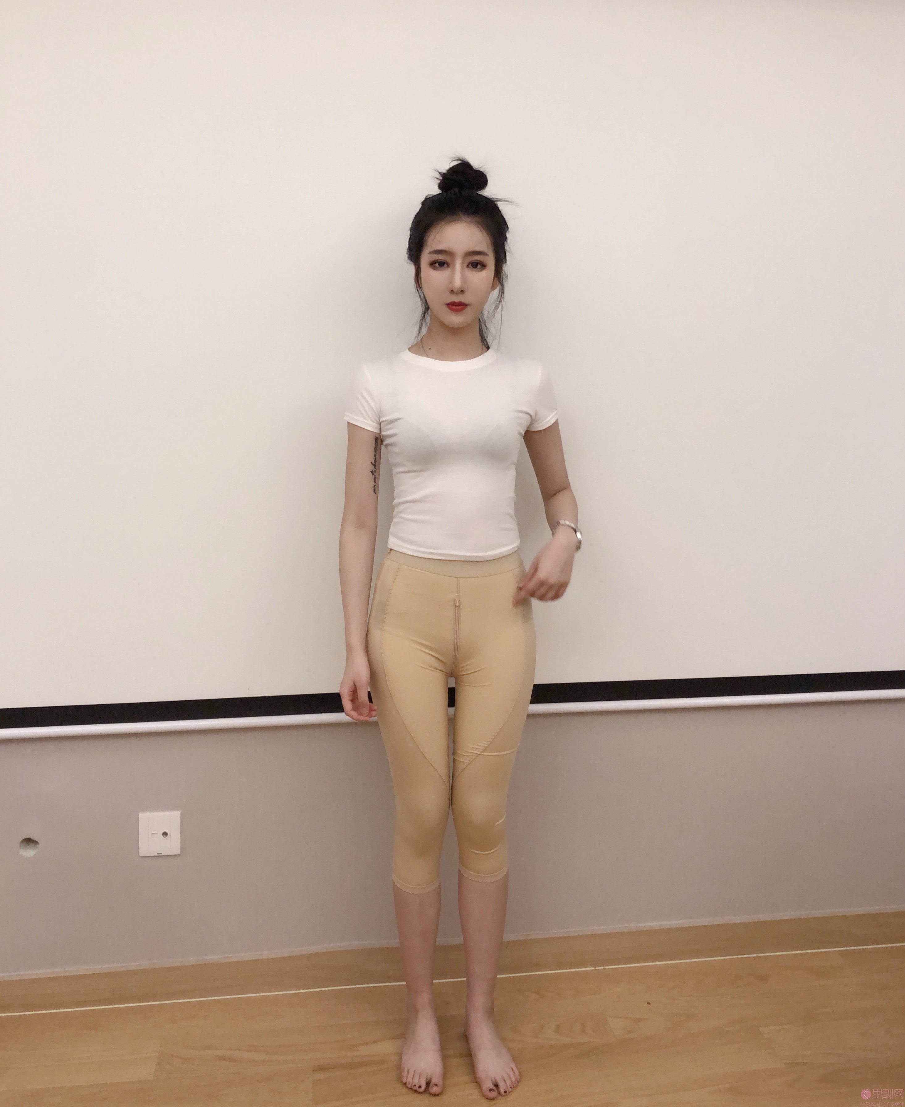 华生医美医疗美容王亚璐医生吸脂怎么样？2020价格表上线+吸脂真人案例反馈
