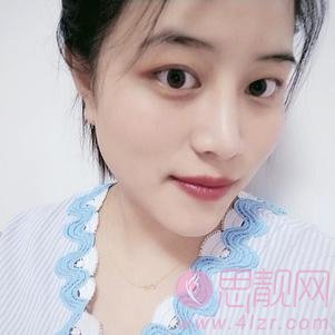 四川省人民医院整形外科隆鼻怎么样?附隆鼻真人案例一览及2020价格一览