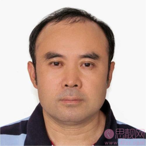北京大学深圳医院整形外科怎么样？附医院简介及2020价格表出炉